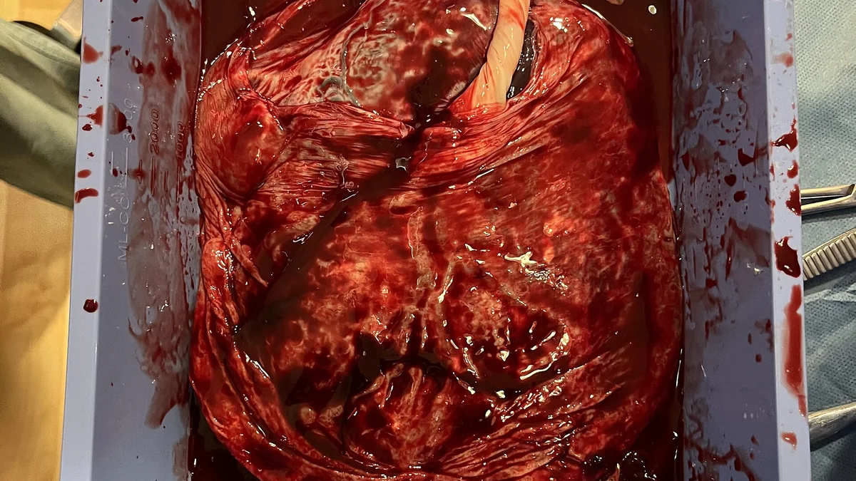 How the Placenta Works