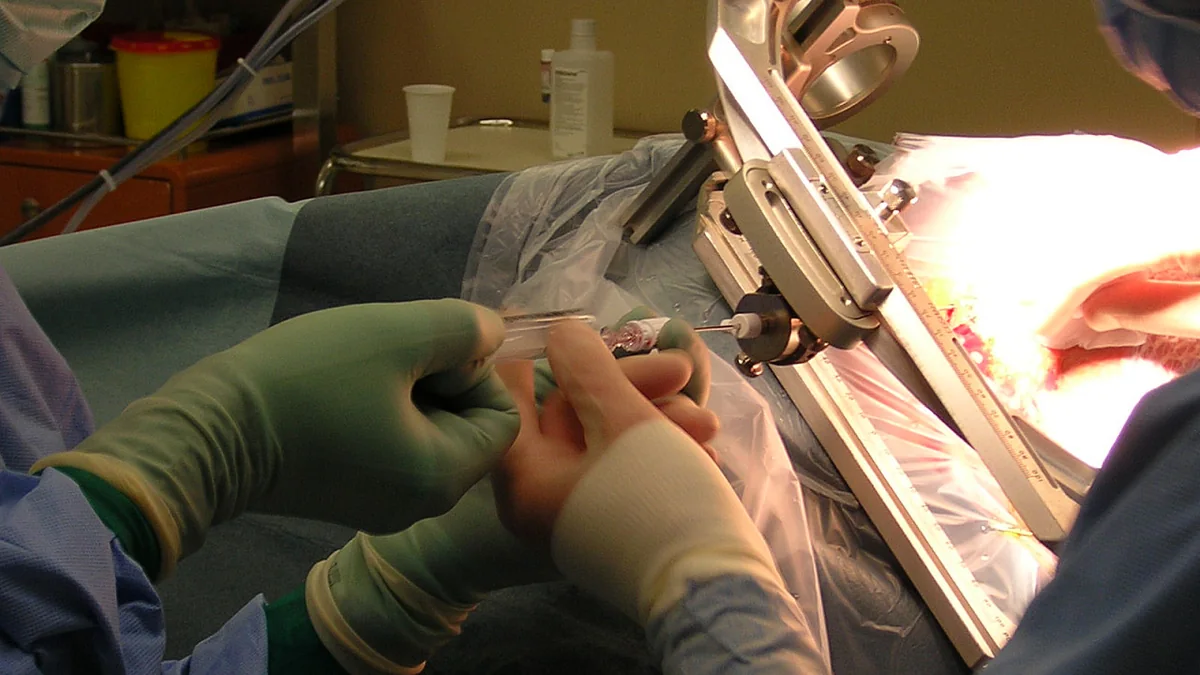 Biopsy