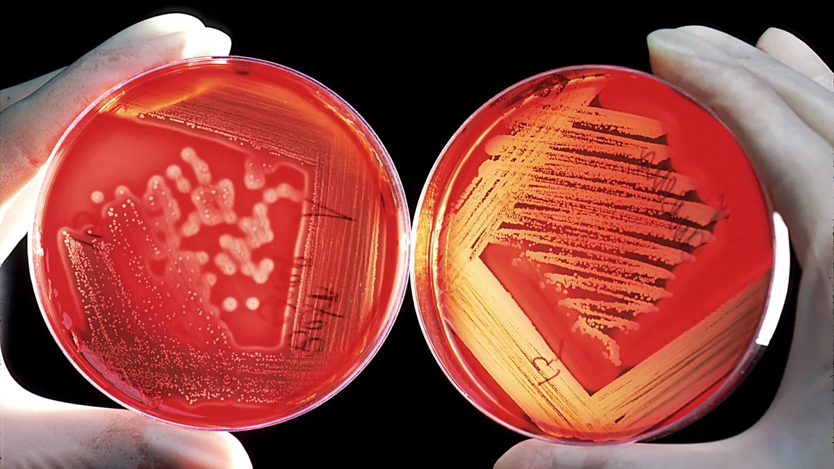 Blood Culture
