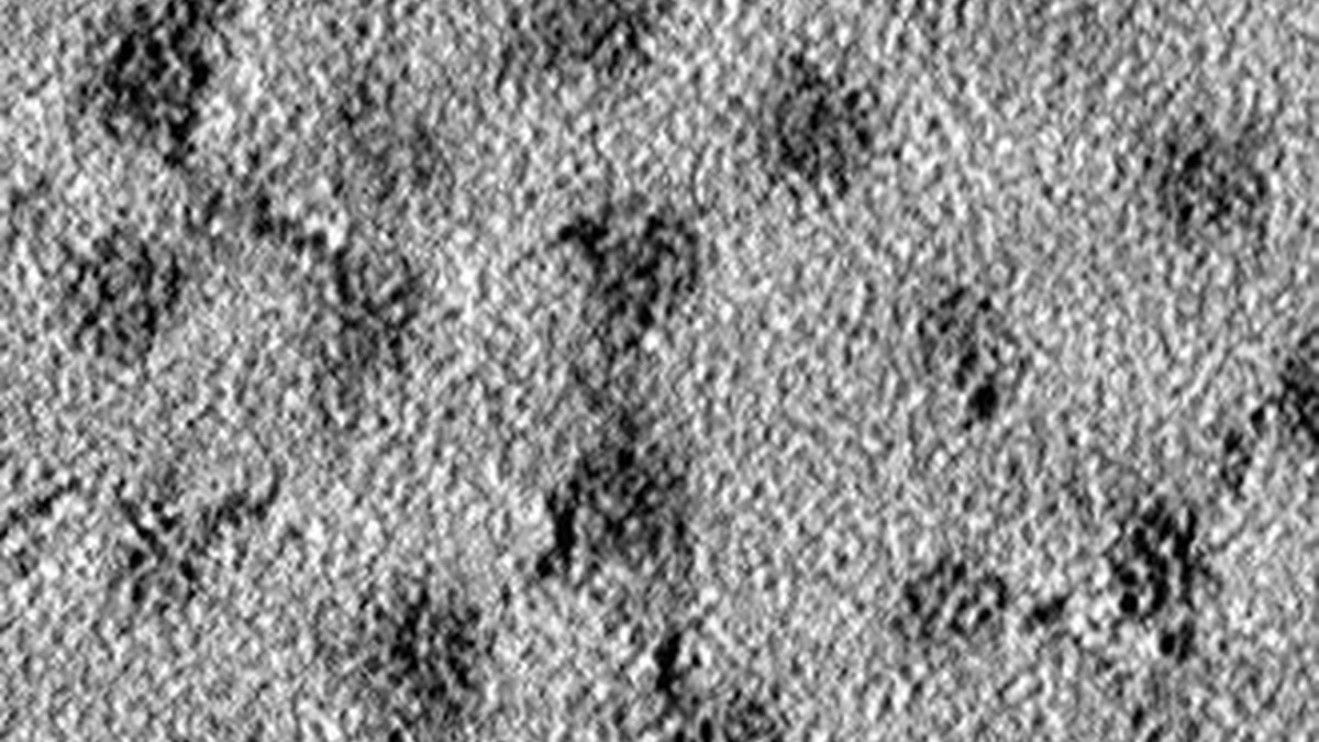 Corneal Dystrophy