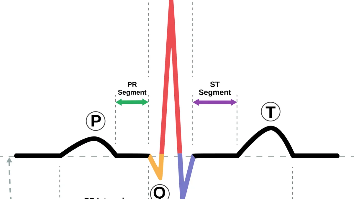 Electrocardiogram (ECG/EKG)
