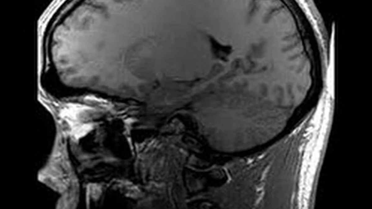 MRI (Magnetic Resonance Imaging)