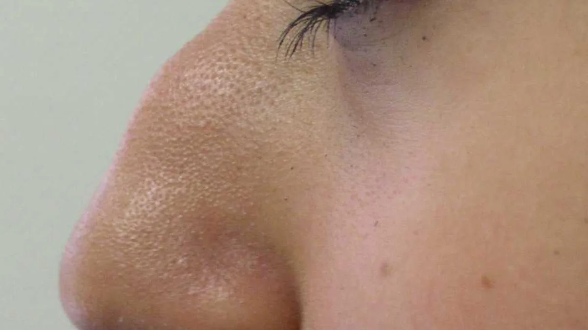 How the Nose and Sinuses Work