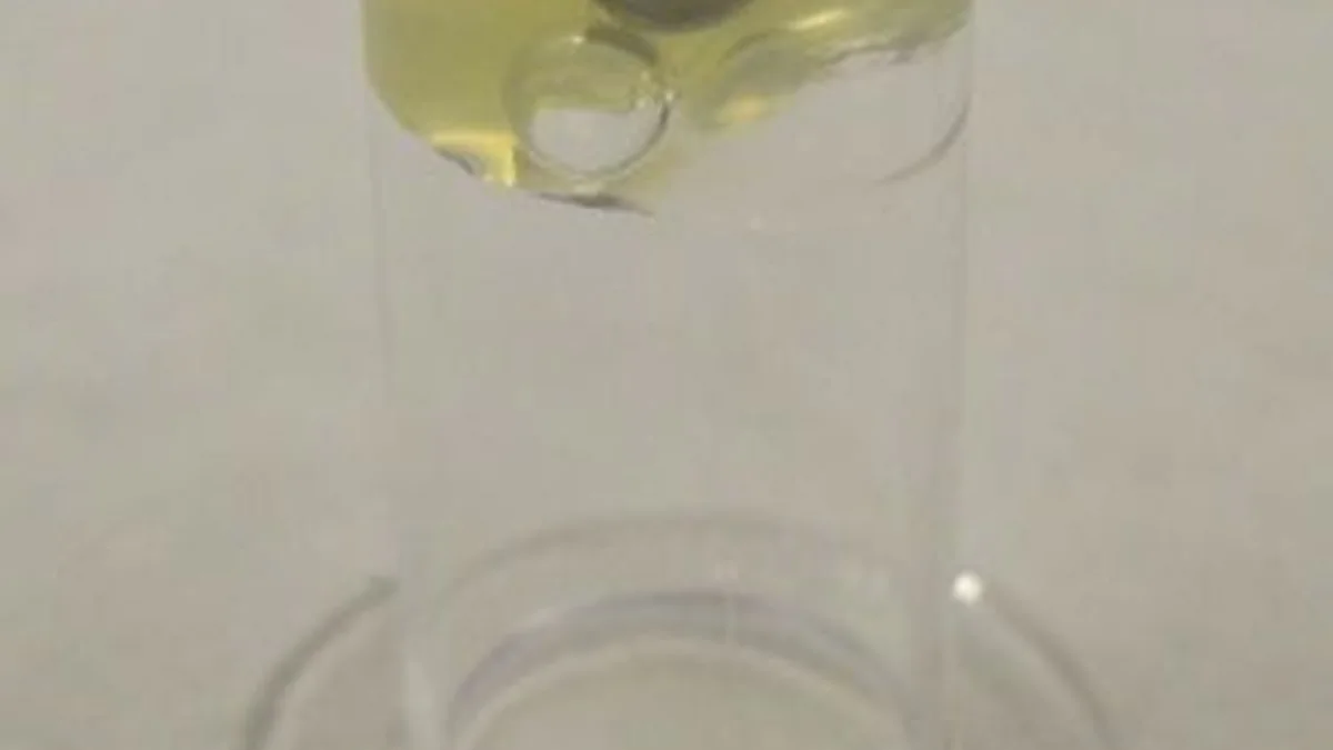 PT/INR (Coagulation Test)