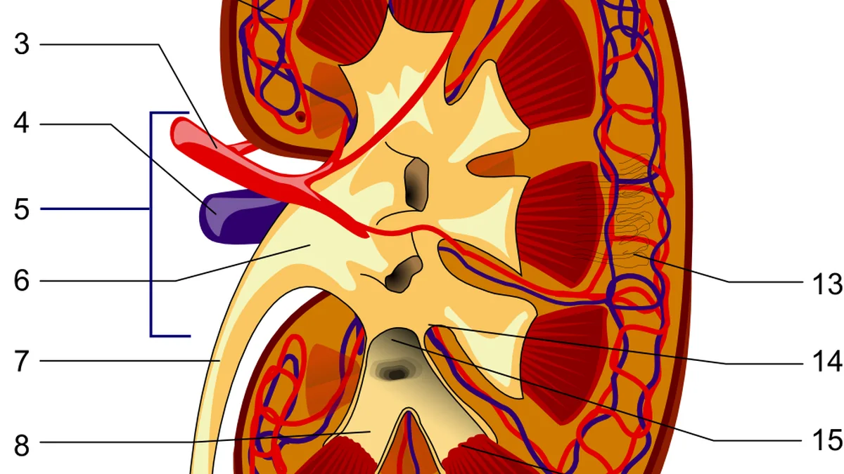 Renal Artery Stenosis