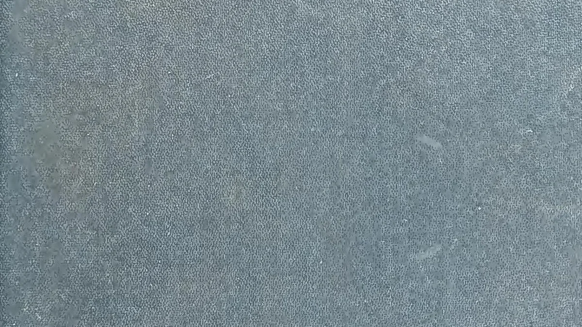 Strabismus (Squint)
