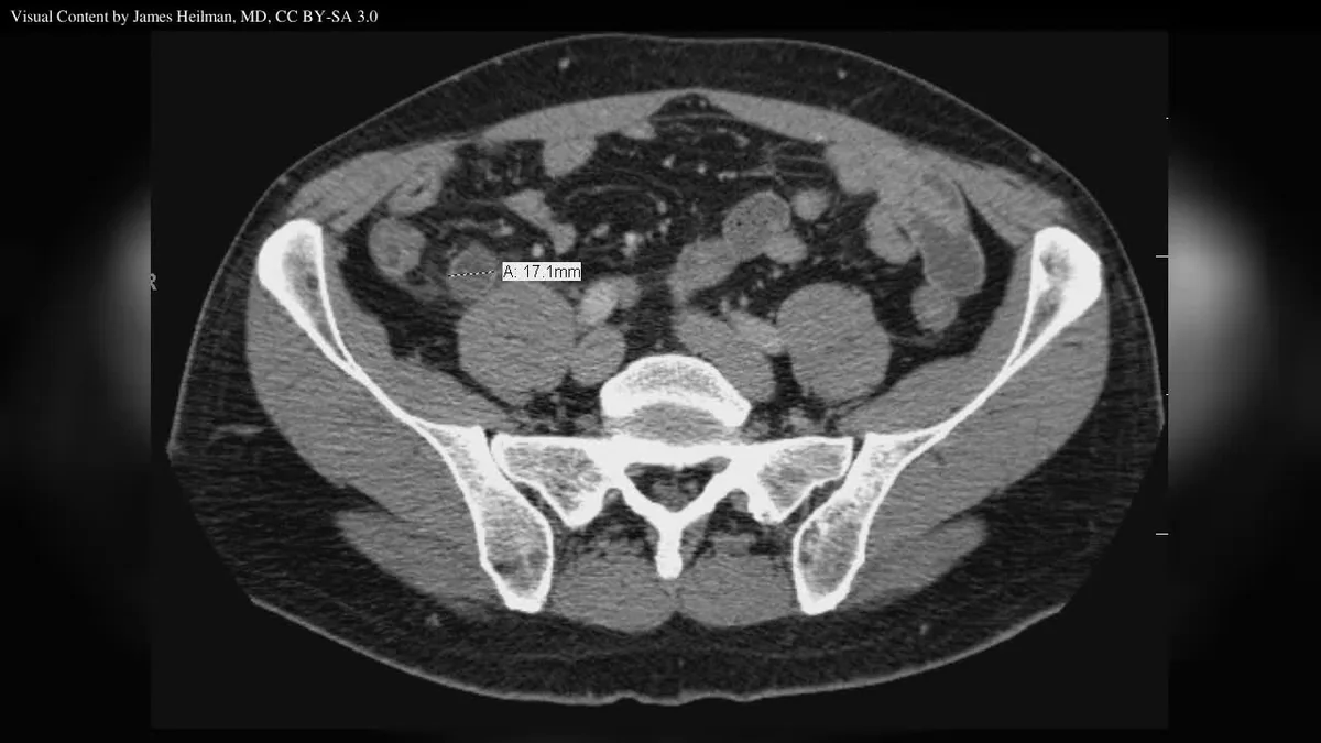 How the Appendix Works
