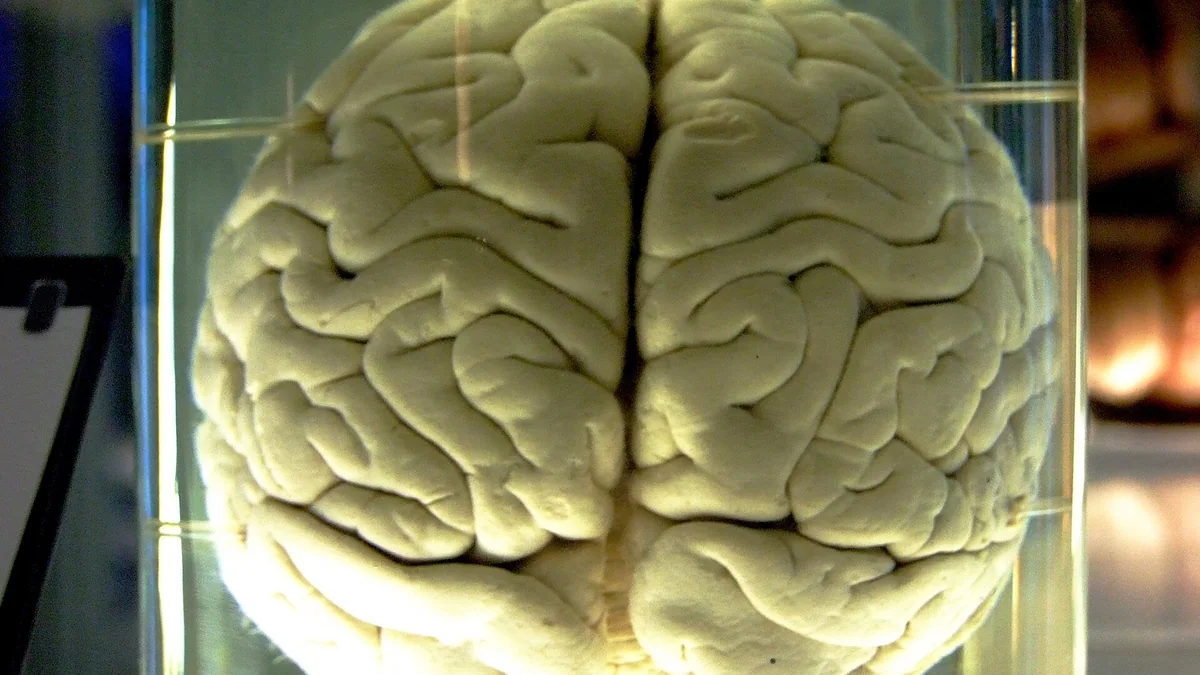How the Brain Works