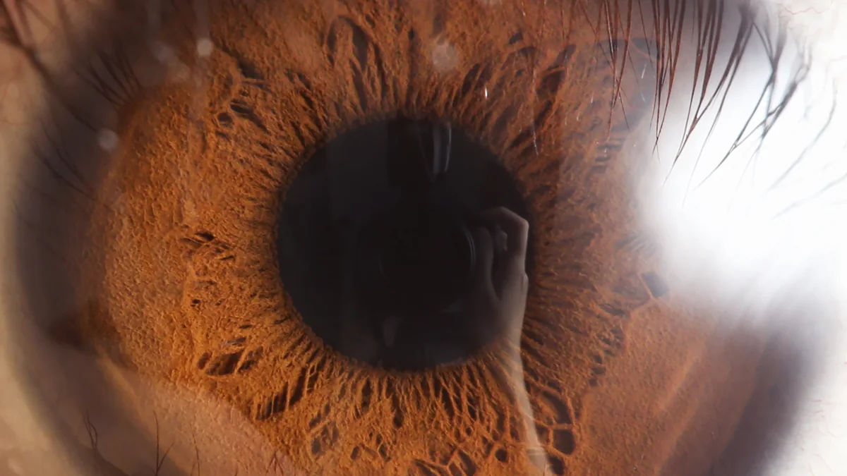 How the Eyes Work