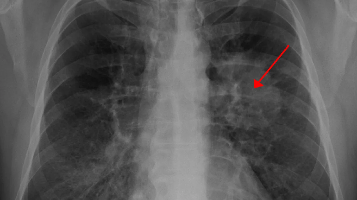 How the Lungs Work